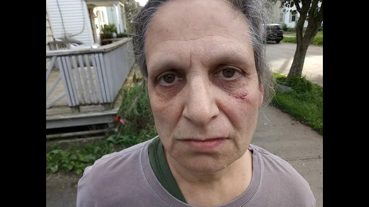 Herkimer Blogger Beaten by Gang Member Shianne Hill