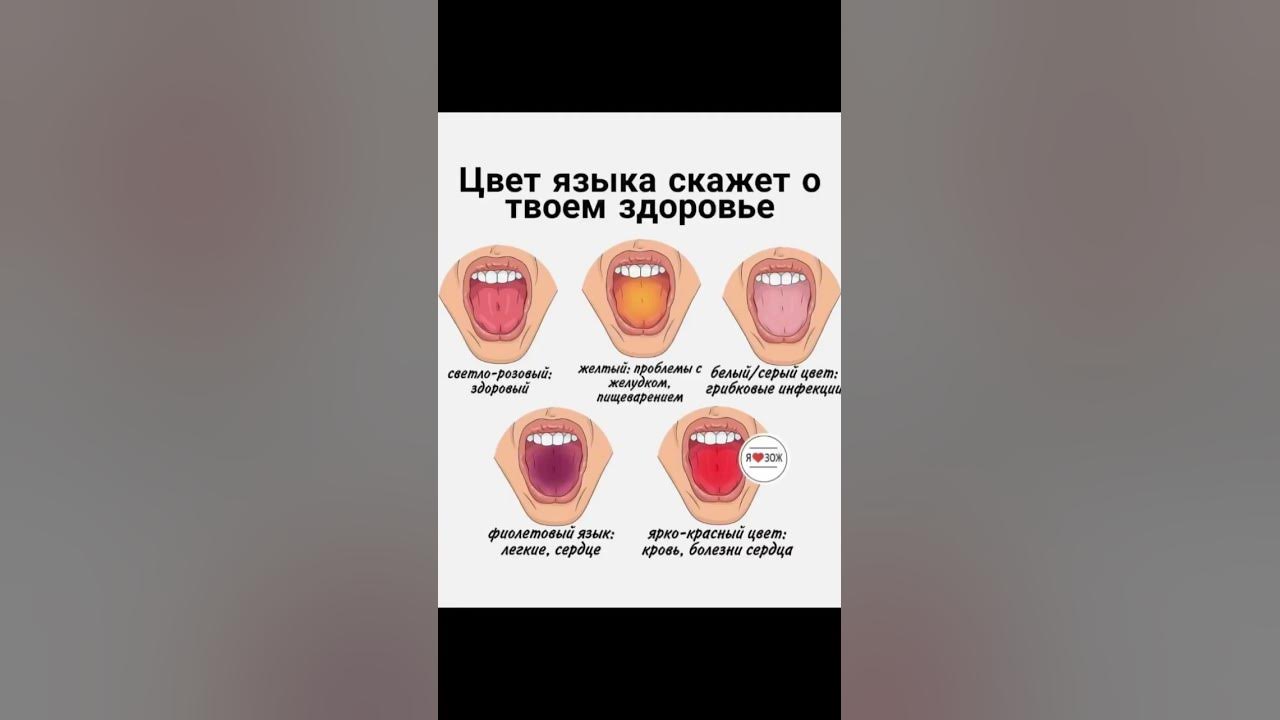 Цвет языка скажет о твоем здоровье - YouTube