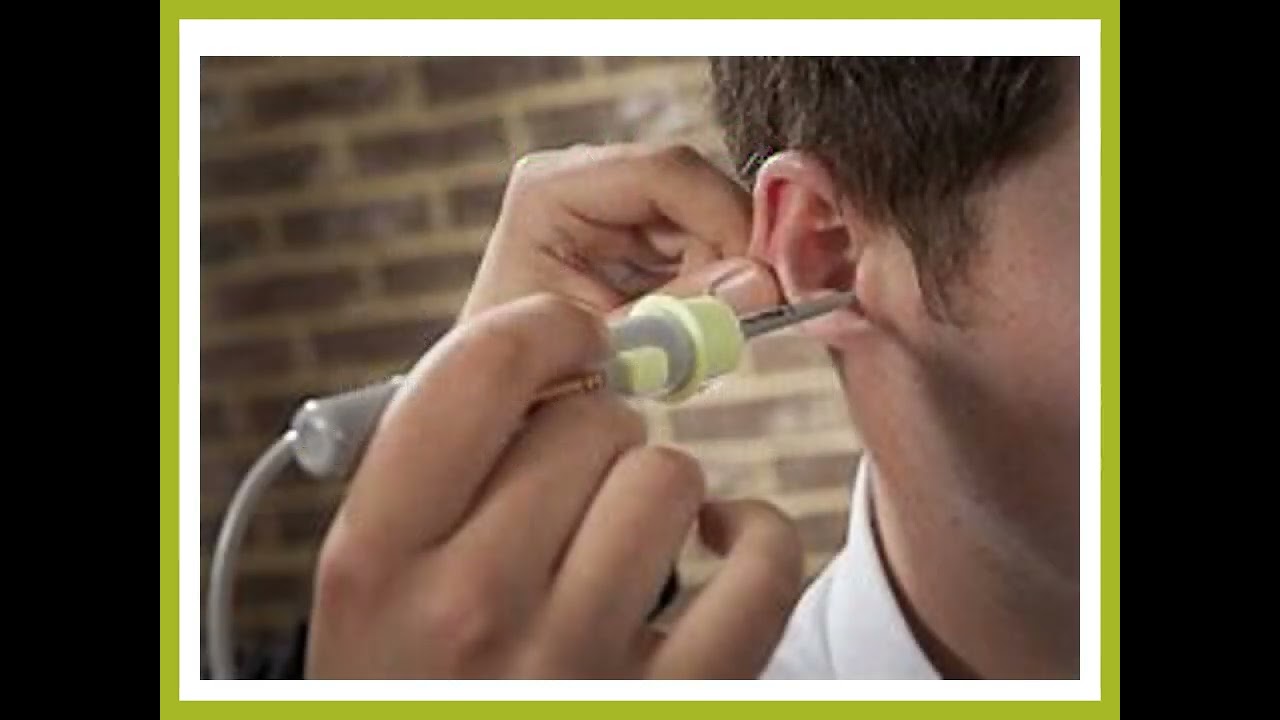 Are you looking for the best Home Visit Ear Wax Removal in Radlett?