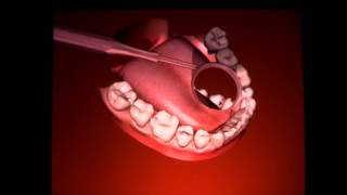 Moog Simodont Dental Trainer - short version