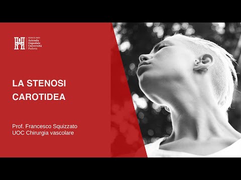 la-stenosi-carotidea