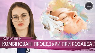 Комбіновані процедури при розацеа