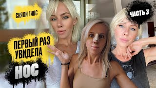 видео: МОЯ РЕАКЦИЯ: ВПЕРВЫЕ ВИЖУ НОС ПОСЛЕ РИНОПЛАСТИКИ. Снимают гипс и сплинты картинка: МОЯ РЕАКЦИЯ: ВПЕРВЫЕ ВИЖУ НОС ПОСЛЕ РИНОПЛАСТИКИ. Снимают гипс и сплинты