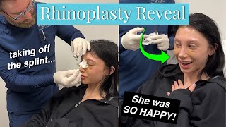 Watch this STUNNING Rhinoplasty Reveal After ONLY Six Days