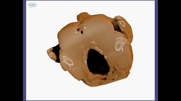 X-ray Microscopic Inspection of Poultry Bones
