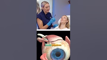 Botox brow lift technique 💉