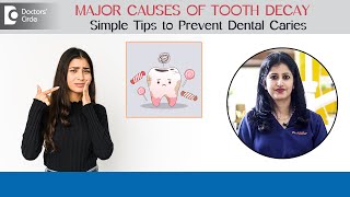 Major Causes of Tooth Decay | Toothpain | National Toothache Day- Dr.Nikhar Ravinder|Doctors Circle