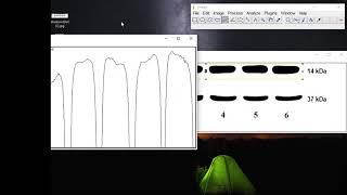 Image J - Western Blot Analysis, by Şeyda Nur GİRGİN