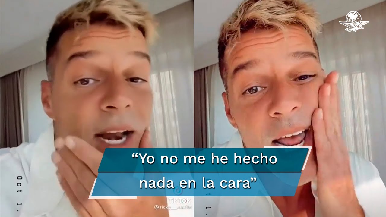 Ricky Martin aclara su rostro y apaga rumores