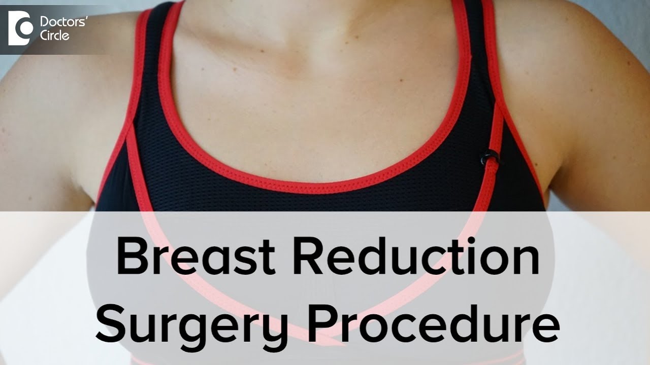 How Is A Breast Reduction Surgery Done Dr Srikanth V Youtube