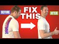 How to Fix Your Posture (INSTANT CHANGES!)