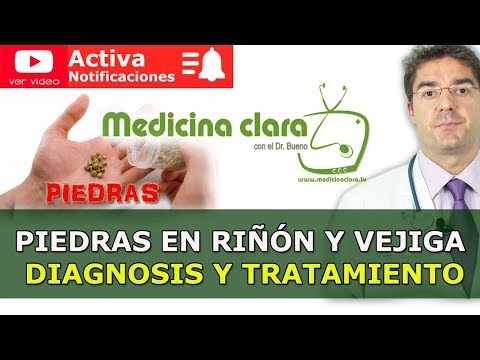 Piedras en el riñón, piedras en la vejiga, cólico nefrítico o renal | Síntomas y tratamiento