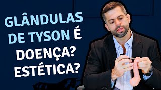 Are Tyson's Glands a Cosmetic Disease? | Dr. Marco Túlio - Urologist and Andrologist