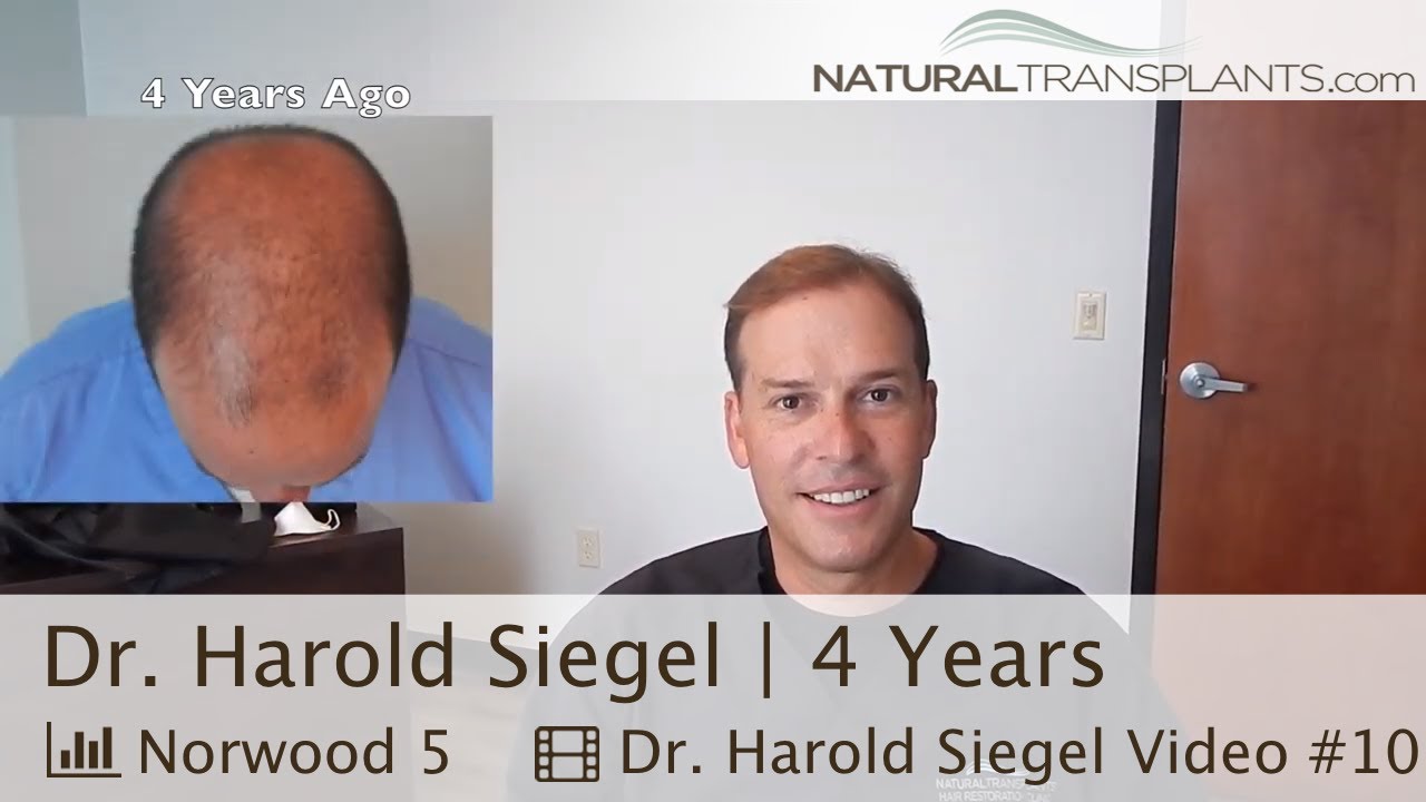 Natural Transplants Doctor Hair Transplant Results | Dr Matt Huebner (Harold)