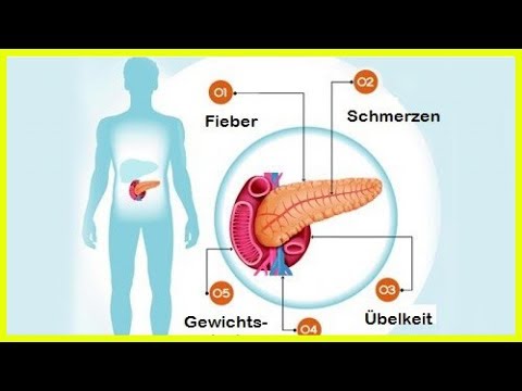 Video: Insulinom Der Bauchspeicheldrüse - Symptome, Behandlung