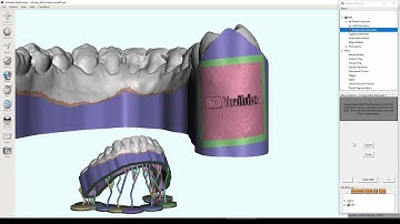 D3Lab x64  -  Emboss Any Image/Text on Dental Models and How to Generate Supports for 3D Printing