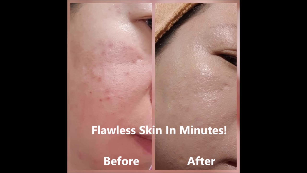 How To Make Skin Look Flawless Naturally Within 3 Minutes Flawless Skin how-to-make-skin-look-flawless-naturally-within-3-minutes-flawless-skin
