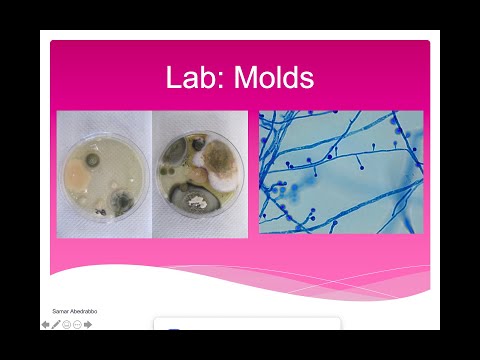 Molds Lab