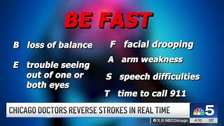 Chicago doctors reverse strokes in real time