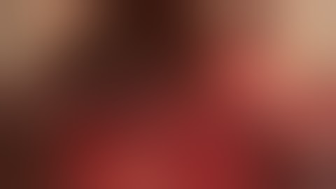 20 Resection for Biliary Malignancy Left Hepatectomy with