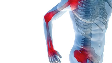 8 Signs You May Have a Thyroid Problem