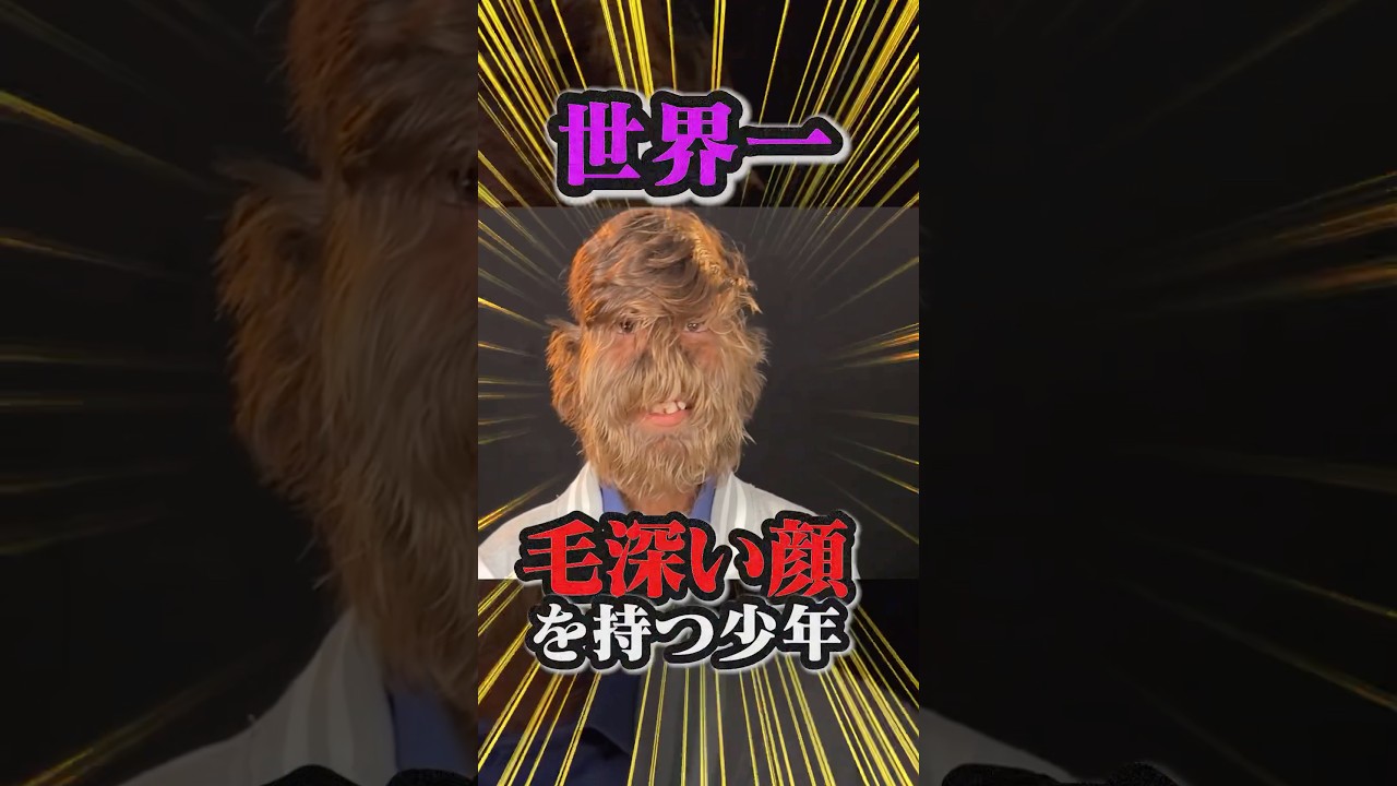 世界一毛深い顔を持つ男性の裏側