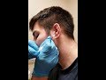 DO NOT GO TO THE DOCTOR! Comprehensive Guide: How To Drain Cauliflower Ear