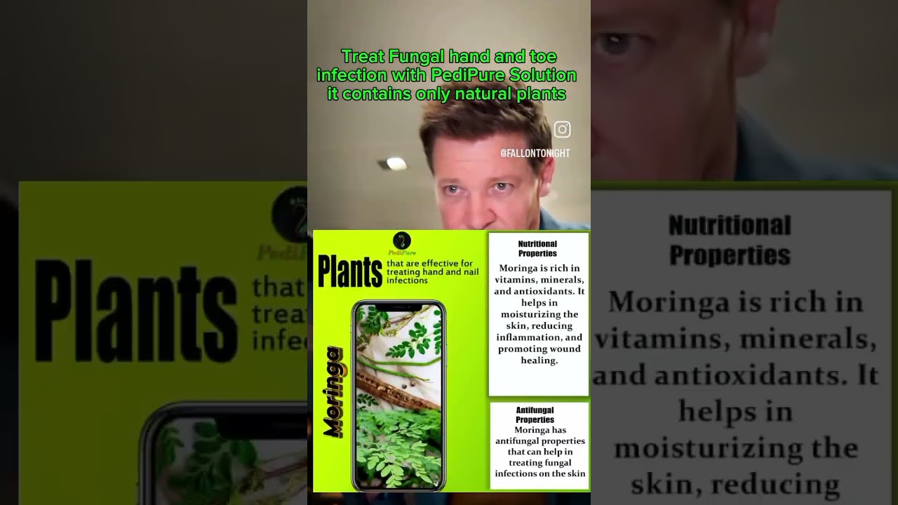 Natural plants used to formulate Pedipure Solution
