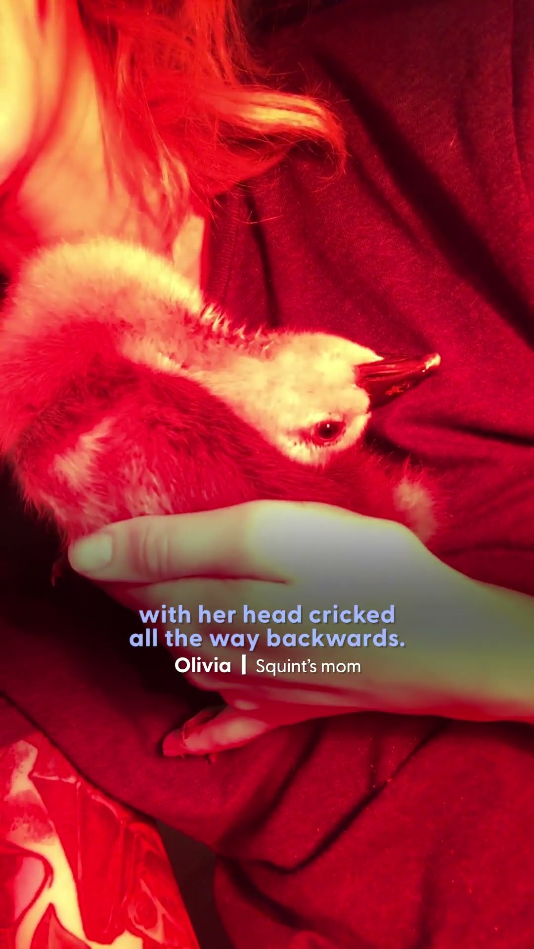 Baby Goose With Crooked Neck Finally Stands Up | The Dodo