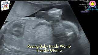 Peeing Baby Inside Womb