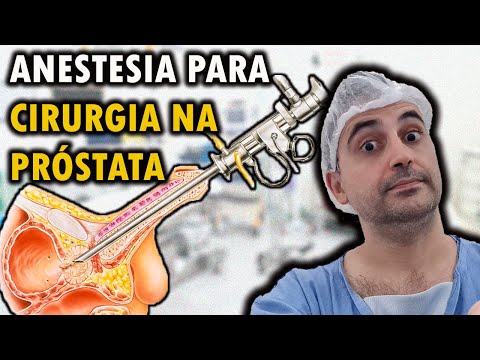 Vídeo: Quem faz a ressecção endoscópica?