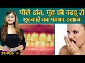 Yellow Teeth, Mouth Odour, Cavities, और Receding gums से यूं निपटें Sehat Ep 14