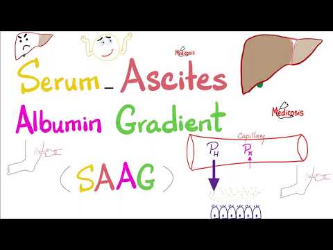 Serum Ascites Albumin Gradient (SAAG) | Peritoneal Effusion | Lab 🧪