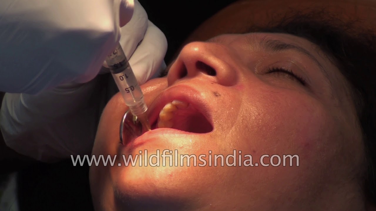 Dental Teeth cleaning in India, Dental Health. YouTube