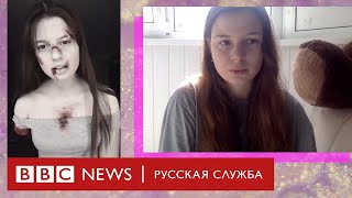 «Люблю шутить про свою руку»: как TikTok помогает принять себя