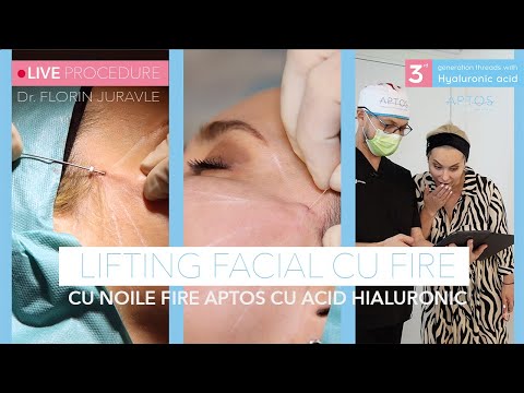 Video: Noul Facial Cu Botox