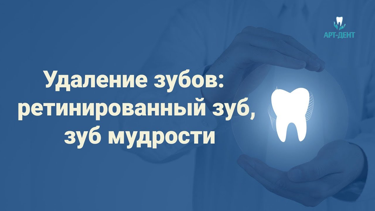 Удаление зубов: ретинированный зуб, зуб мудрости - YouTube