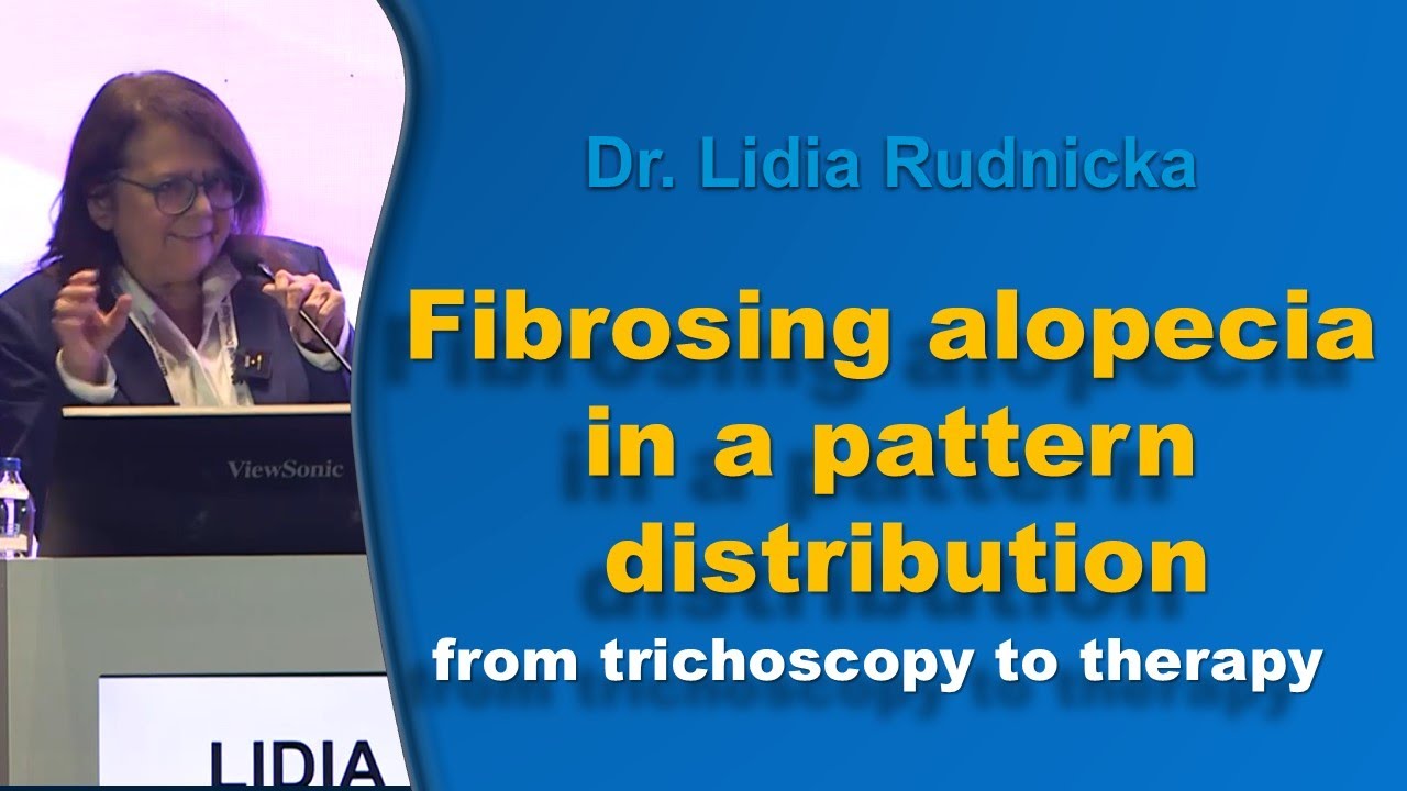Fibrosing alopecia in a pattern distribution. From trichoscopy to therapy