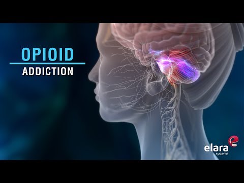 What is Opioid Addiction? Animation Video Answers the Question.