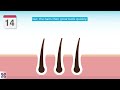 The Cosmetic Clinic Laser Hair Removal Animation