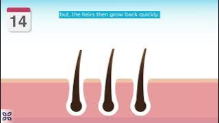 The Cosmetic Clinic Laser Hair Removal Animation