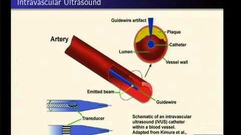 Generalized Radon transforms in tomography