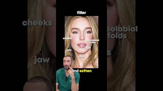 Alex Cooper’s dramatic transformation,injectables only or secret surgery  #filler #beforeandafter