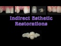 Esthetic Professionals-Mastering Indirect Esthetic Restorations Residency