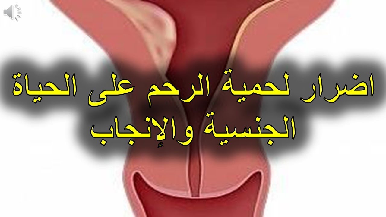 لحمية عنق الرحم