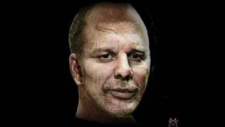 Celebrity Mickey Rourkes Face Transformation Wealth