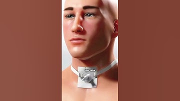Tracheotomy Procedure!! (3D Animation) #drone #theflash #space #automobile #scifi #humanhand