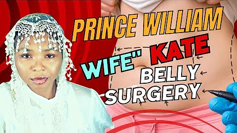 PRINCE WILLIAM WIFE KATE SURGERY HIDDEN IN PLAIN SIGHT!! #WEARENEAR #2ndexodus #itistime