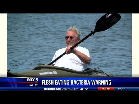 Flesh Eating Bacteria Ft Myers Beach Florida Flesh Eating Bacteria Ft Myers Beach Florida