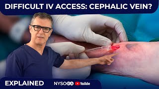 Difficult Iv Access Cephalic Vein?